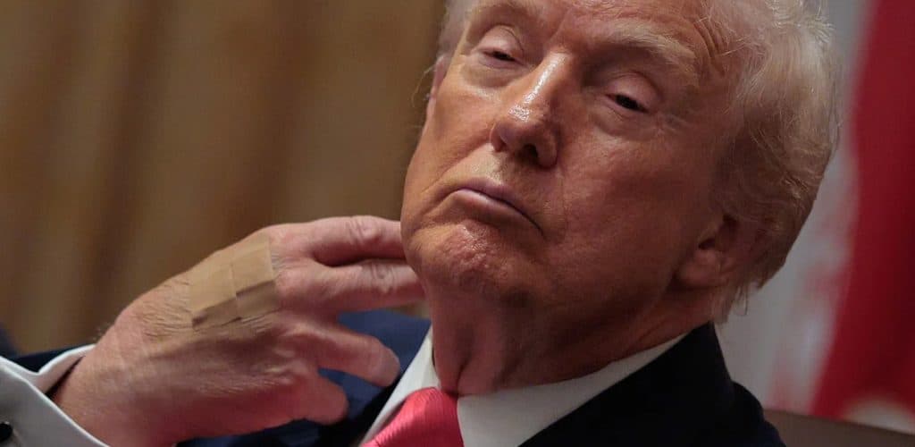 Trump's Health Report: Takes 3 Meds, Needs to Lose Weight